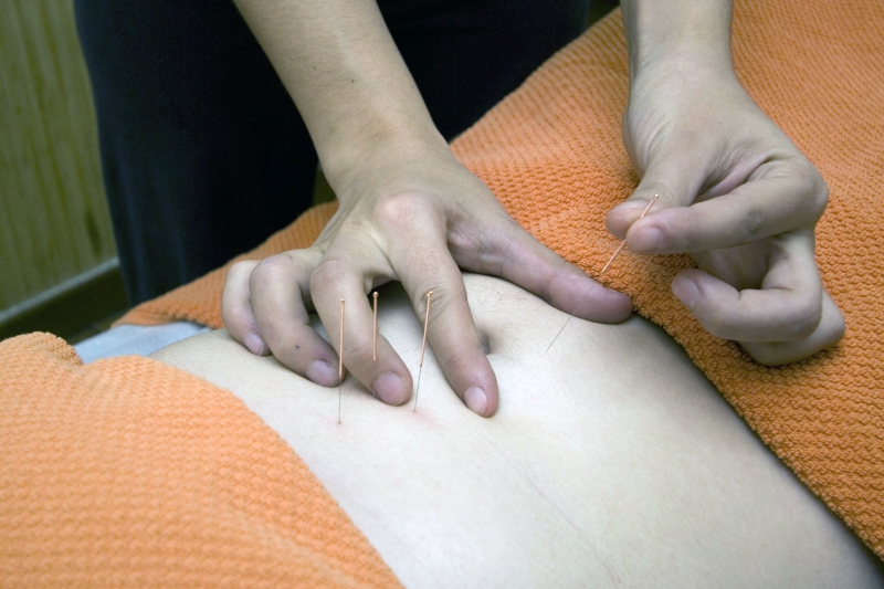 osteopathe-BERRE LES ALPES-min_acupuncture-4175625